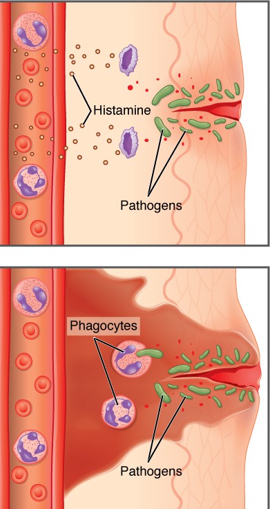 2213_Inflammatory_Process